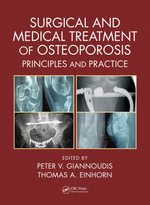 Surgical and Medical Treatment of Osteoporosis 