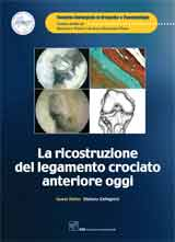 La Ricostuzione del Legamento Crociato Anteriore Oggi