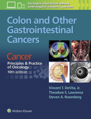 Colon and Other Gastrointestinal Cancers 10th ed