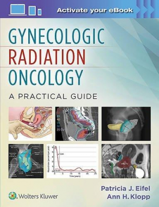 Gynecologic Radiation Oncology: A Practical Guide 