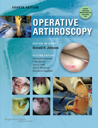 Operative Arthroscopy 4th edition