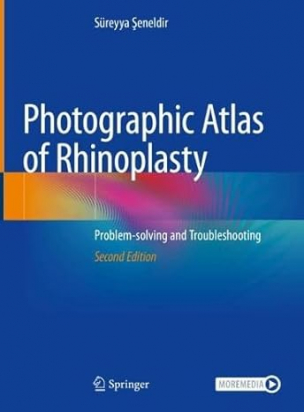 Photographic Atlas of Rhinoplasty