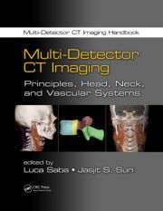 Multi-Detector CT Imaging: Principles, Head, Neck, and Vascular Systems