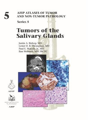 AFIP series 5 Fasc. 5  Tumors of the Salivary Glands