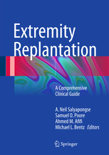 Extremity Replantation