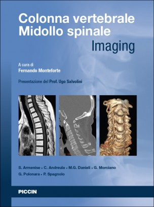 Colonna Vertebrale Midollo Spinale - Imaging