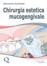 Chirurgia Estetica Mucogengivale