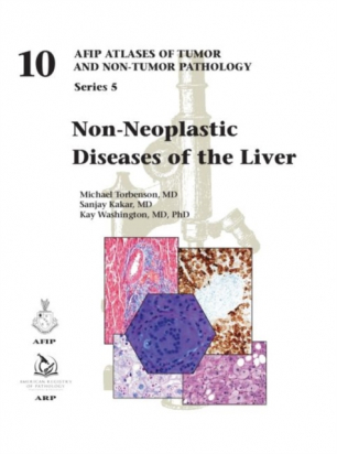 AFIP series 5 Fasc. 10  Non-Neoplastic Diseases of the Liver