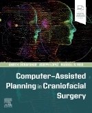 Computer-Assisted Planning in Craniofacial Surgery