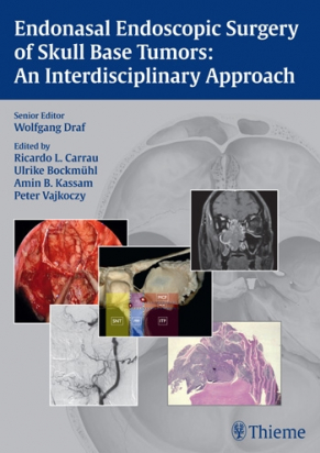 Endonasal Endoscopic Surgery of Skull Base Tumors