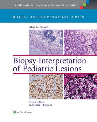 Biopsy Interpretation of Pediatric Lesions