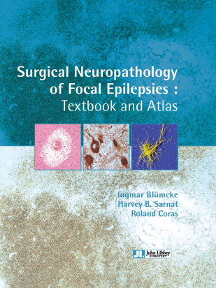 Surgical Neuropathology of Focal Epilepsies