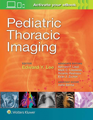 Pediatric Thoracic Imaging