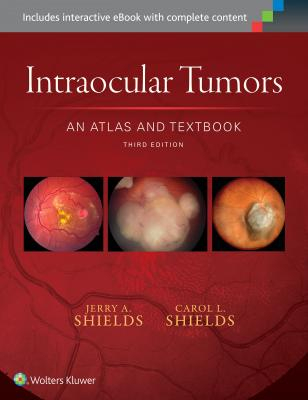 Intraocular Tumors