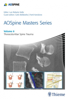 AOSpine Masters Series, Volume 6: Thoracolumbar Spine Trauma