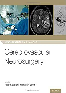 Cerebrovascular Neurosurgery