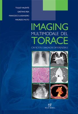 Imaging Multimodale del Torace