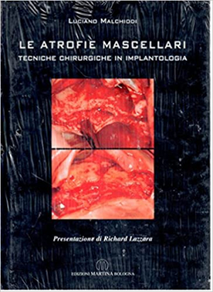 Le Atrofie Mascellari