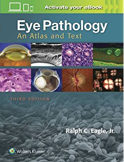 Eye Pathology, 3e 