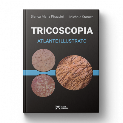 Tricoscopia