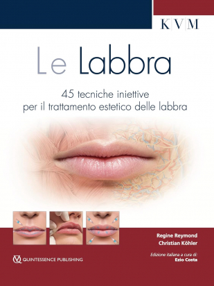Le labbra -45 tecniche iniettive per il trattamento estetico delle labbra