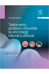 Trattamento protesico rimovibile su ancoraggi naturali e artificiali
