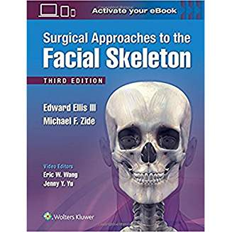 Surgical Approaches to the Facial Skeleton, 3e 
