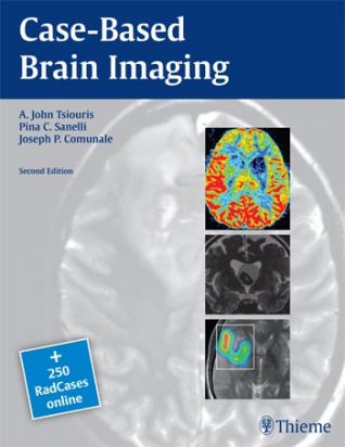 Case-Based Brain Imaging, 2nd ed