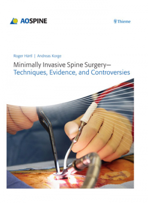 Minimally Invasive Spine Surgery - Techniques, Evidence, and Controversies 