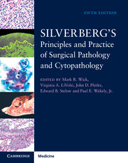 Silverberg's Principles and Practice of Surgical Pathology and Cytopathology 4 Volume Set