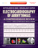 Electrocardiography of Arrhythmias