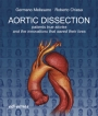 Aortic Dissection