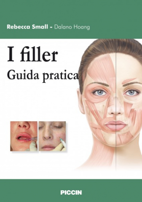 I filler - Guida pratica