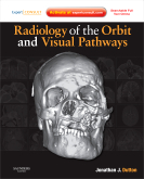 Radiology of the Orbit and Visual Pathways