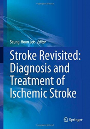 Stroke Revisited: Diagnosis and Treatment of Ischemic Stroke