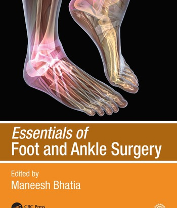 Essentials of Foot and ankle Surgery