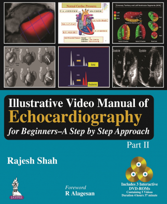 Illustrative Video Manual of Echocardiography for Beginners: A Step by Step Approach (Part II)