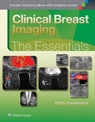 Clinical Breast Imaging 