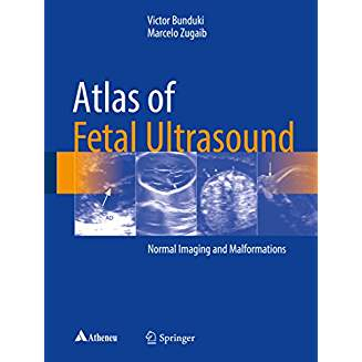 Atlas of Fetal Ultrasound