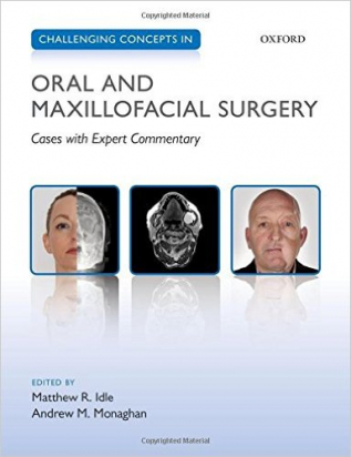 Challenging Concepts in Oral and Maxillofacial Surgery