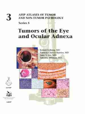 AFIP series 5 fasc. 3 Tumors of the Eye and Ocular Adnexa
