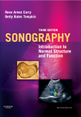 Sonography, 3rd Edition