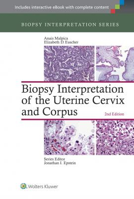 Biopsy Interpretation of the Uterine Cervix and Corpus, 2e