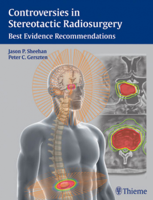 Controversies in Stereotactic Radiosurgery   Best Evidence Recommendations 