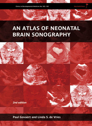 An Atlas of Neonatal Brain Sonography, 2nd Edition