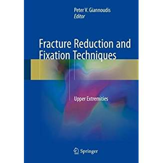 Fracture Reduction and Fixation Techniques