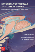 External Ventricular And Lumbar Drains: Indications, Procedures, And Patient Care