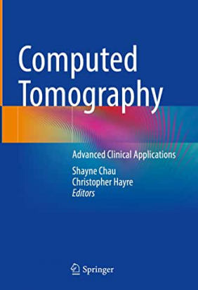 Computed Tomography