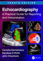 Echocardiography 4th ed