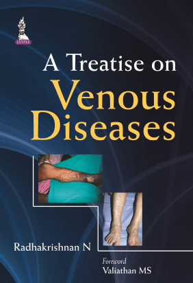 A Treatise on Venous Diseases